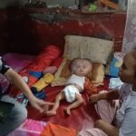 Kondisi Goffi bayi derita Hidrosefalus di Subang hanya bisa terbaring di kasur dengan kondisi kepala membesar (FOTO: KOMPAS.COM / AHYA NURDIN)(Ahya Nurdin )